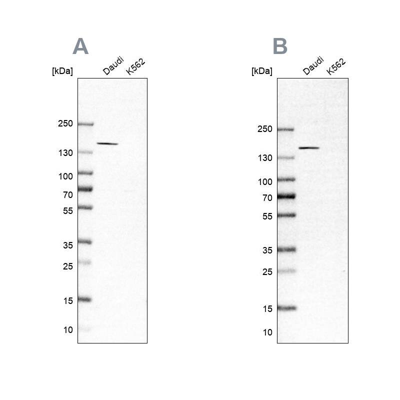 PLC-gamma 2 Antibody - BSA Free Western Blot: PLC-gamma 2 Antibody - BSA Free [NBP1-86030]