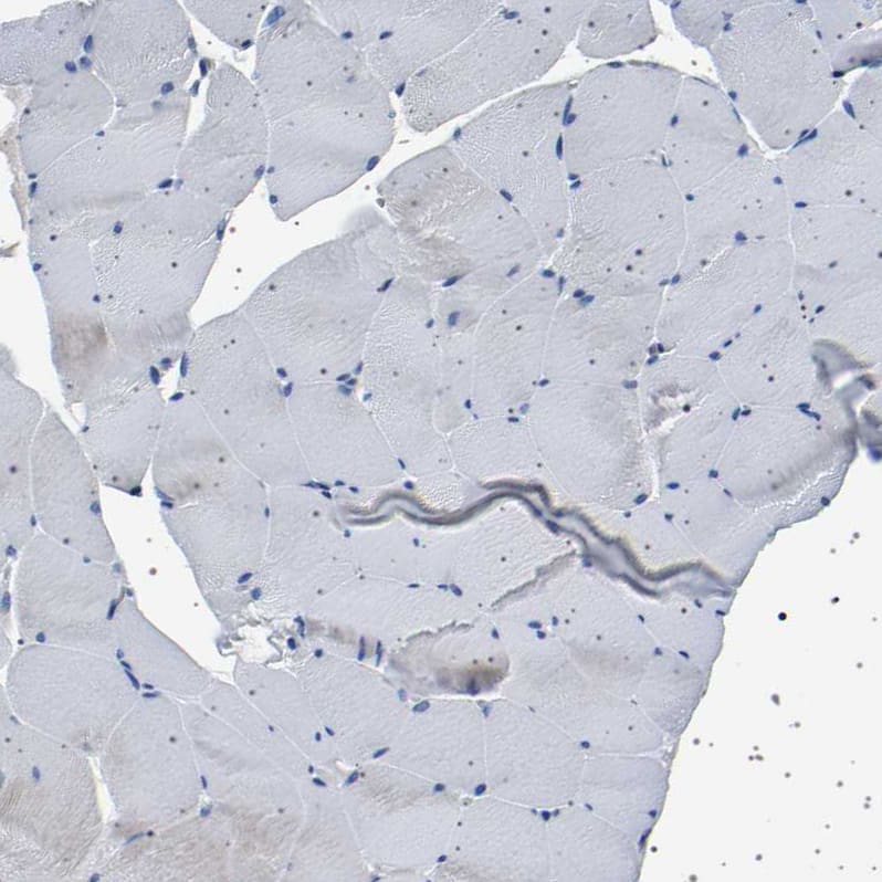 58K Golgi Protein Antibody - BSA Free Immunohistochemistry-Paraffin: 58K Golgi Protein Antibody - BSA Free [NBP1-86031]