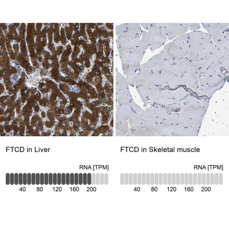 58K Golgi Protein Antibody - BSA Free Immunohistochemistry-Paraffin: 58K Golgi Protein Antibody - BSA Free [NBP1-86031]