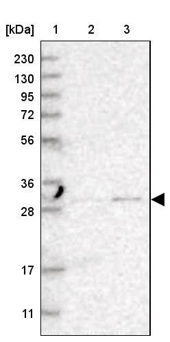 TPMT Antibody - BSA Free Western Blot: TPMT Antibody - BSA Free [NBP1-86032]