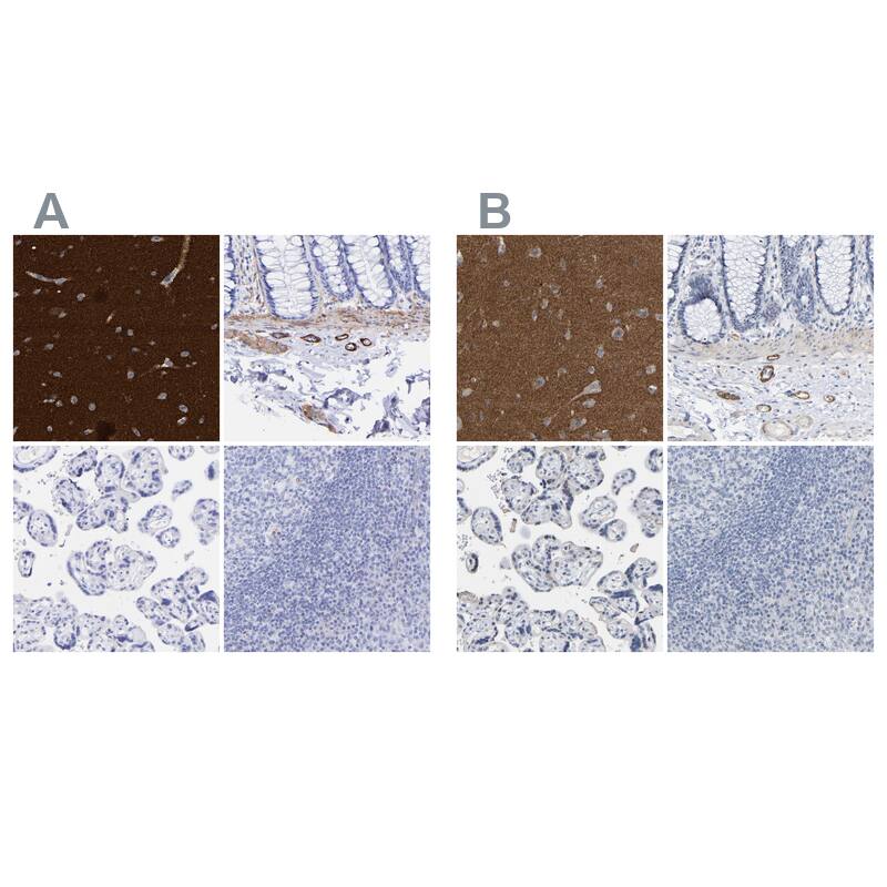 Amphiphysin/AMPH Antibody - BSA Free Immunohistochemistry-Paraffin: Amphiphysin/AMPH Antibody - BSA Free [NBP1-86033]