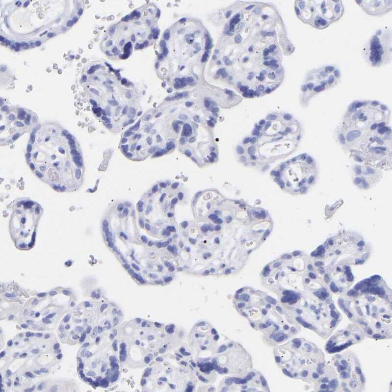 Amphiphysin/AMPH Antibody - BSA Free Immunohistochemistry-Paraffin: Amphiphysin/AMPH Antibody - BSA Free [NBP1-86033]