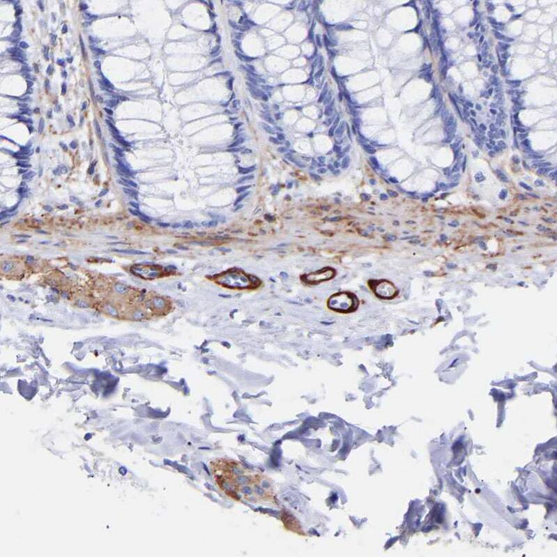 Amphiphysin/AMPH Antibody - BSA Free Immunohistochemistry-Paraffin: Amphiphysin/AMPH Antibody - BSA Free [NBP1-86033]