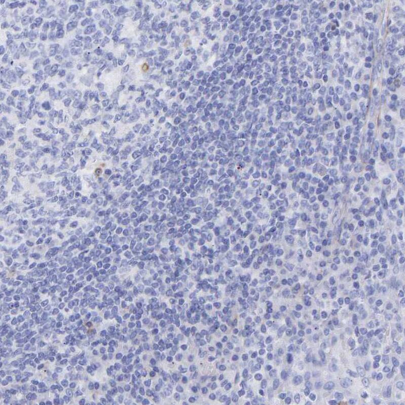 Amphiphysin/AMPH Antibody - BSA Free Immunohistochemistry-Paraffin: Amphiphysin/AMPH Antibody - BSA Free [NBP1-86033]