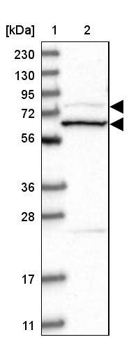 Amphiphysin/AMPH Antibody - BSA Free Western Blot: Amphiphysin/AMPH Antibody - BSA Free [NBP1-86033]