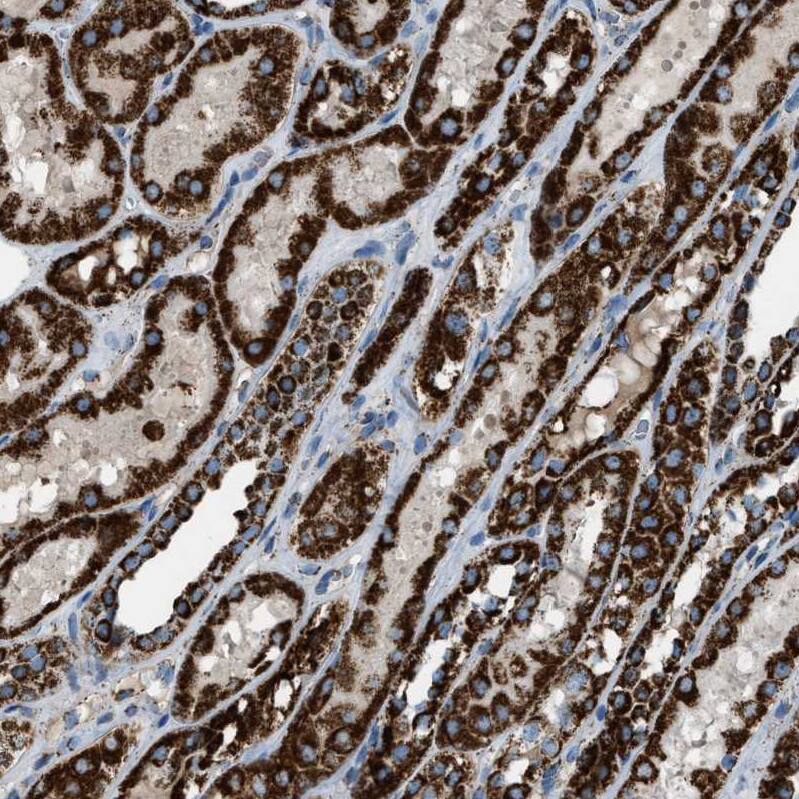 MDH2 Antibody - BSA Free Immunohistochemistry-Paraffin: MDH2 Antibody - BSA Free [NBP1-86036]