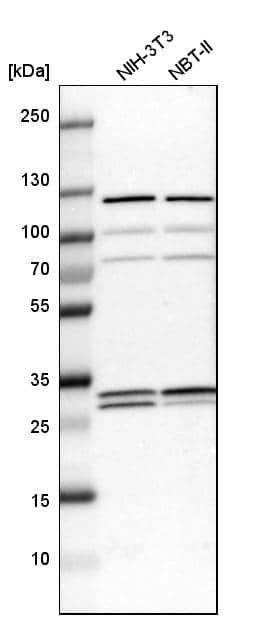 ETFB Antibody - BSA Free Western Blot: ETFB Antibody - BSA Free [NBP1-86040]
