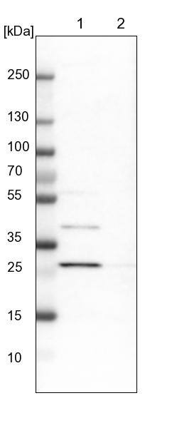 AK2 Antibody - BSA Free Western Blot: AK2 Antibody - BSA Free [NBP1-86043]