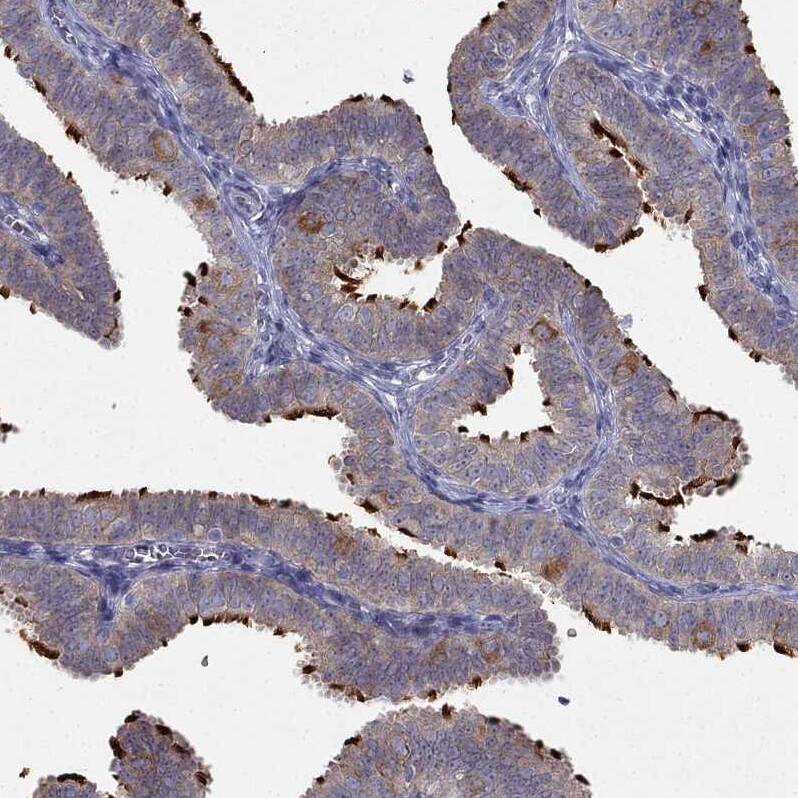 RTDR1 Antibody - BSA Free Immunohistochemistry-Paraffin: RTDR1 Antibody - BSA Free [NBP1-86045]