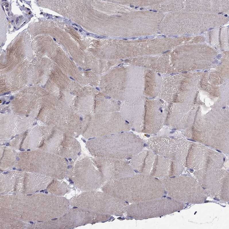 RTDR1 Antibody - BSA Free Immunohistochemistry-Paraffin: RTDR1 Antibody - BSA Free [NBP1-86045]
