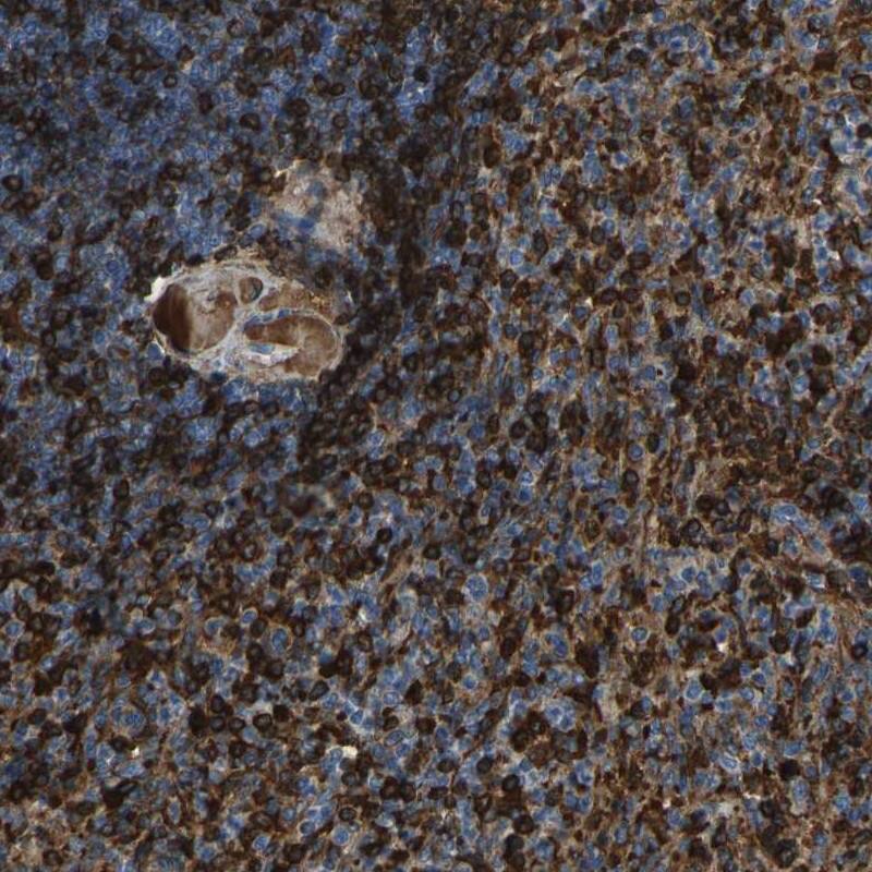 PIGS Antibody - BSA Free Immunohistochemistry-Paraffin: PIGS Antibody [NBP1-86050]