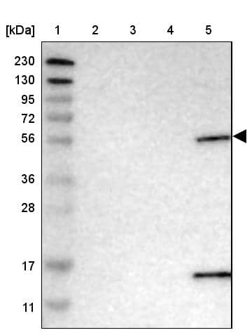 PIGS Antibody - BSA Free Western Blot: PIGS Antibody - BSA Free [NBP1-86050]