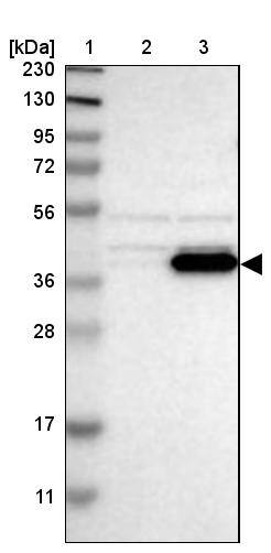 BCKDK Antibody - BSA Free Western Blot: BCKDK Antibody - BSA Free [NBP1-86052]