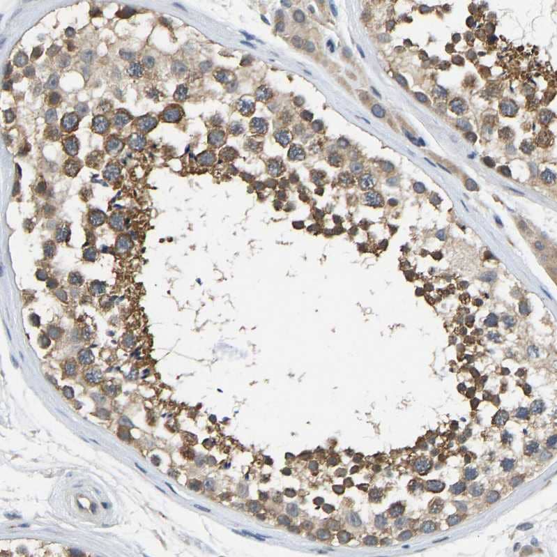 NDRG3 Antibody - BSA Free Immunohistochemistry-Paraffin: NDRG3 Antibody - BSA Free [NBP1-86054]