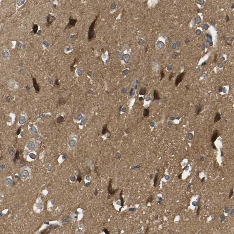 NDRG3 Antibody - BSA Free Immunohistochemistry-Paraffin: NDRG3 Antibody - BSA Free [NBP1-86054]