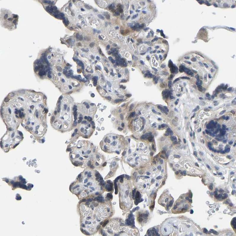 NDRG3 Antibody - BSA Free Immunohistochemistry-Paraffin: NDRG3 Antibody - BSA Free [NBP1-86054]