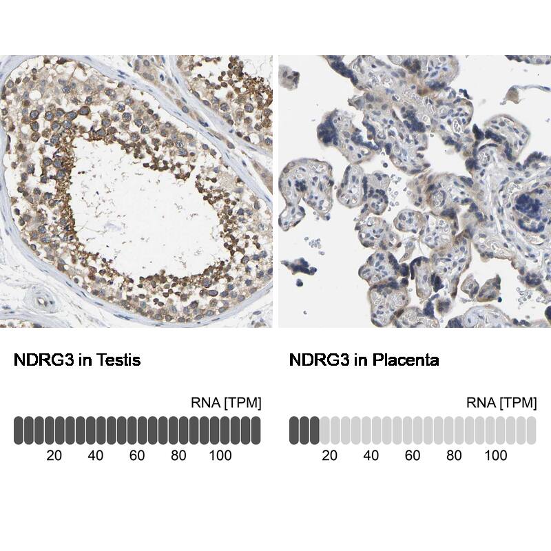 NDRG3 Antibody - BSA Free Immunohistochemistry-Paraffin: NDRG3 Antibody - BSA Free [NBP1-86054]