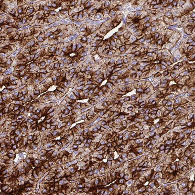 Chromogranin A Antibody - BSA Free Immunohistochemistry-Paraffin: Chromogranin A Antibody - BSA Free [NBP1-86056]