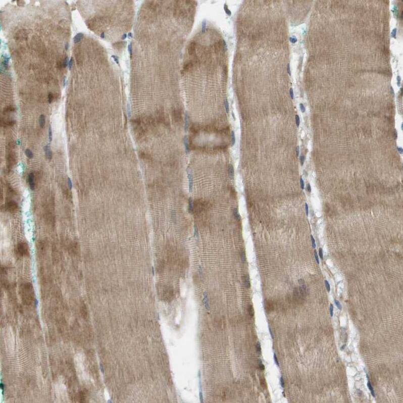 SCN4B Antibody - BSA Free Immunohistochemistry-Paraffin: SCN4B Antibody - BSA Free [NBP1-86057]