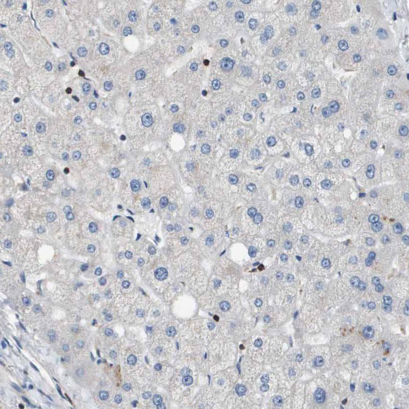 SCN4B Antibody - BSA Free Immunohistochemistry-Paraffin: SCN4B Antibody - BSA Free [NBP1-86057]