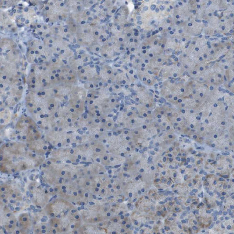 GALNT6 Antibody - BSA Free Immunohistochemistry-Paraffin: GALNT6 Antibody - BSA Free [NBP1-86059]