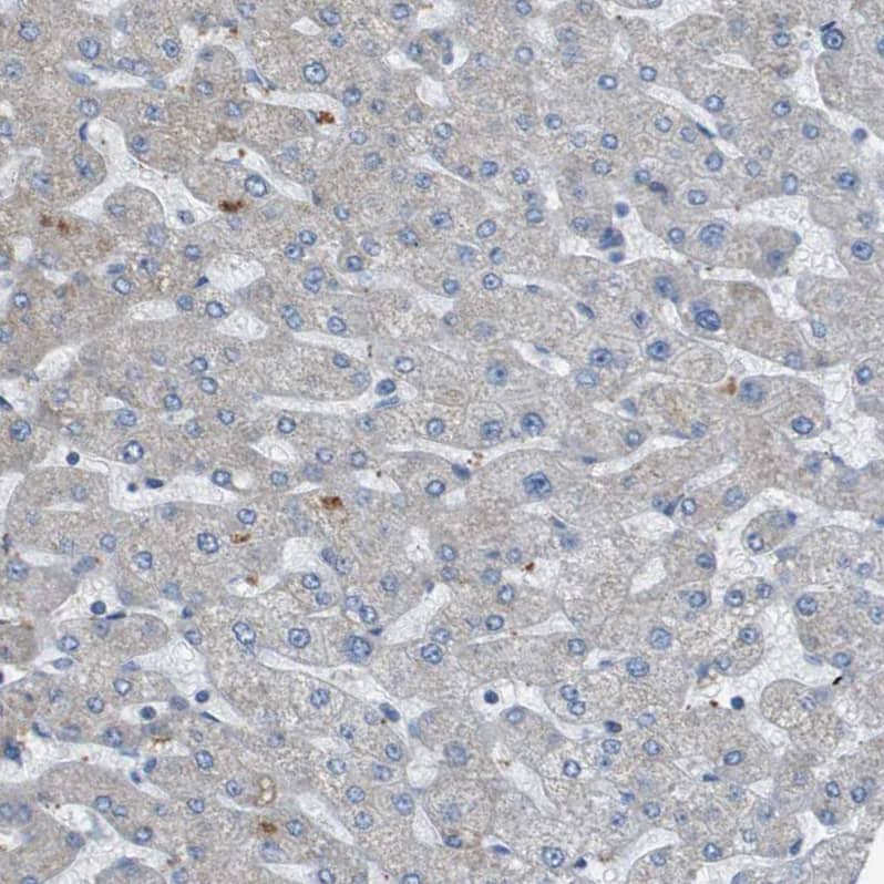 GALNT6 Antibody - BSA Free Immunohistochemistry-Paraffin: GALNT6 Antibody - BSA Free [NBP1-86059]