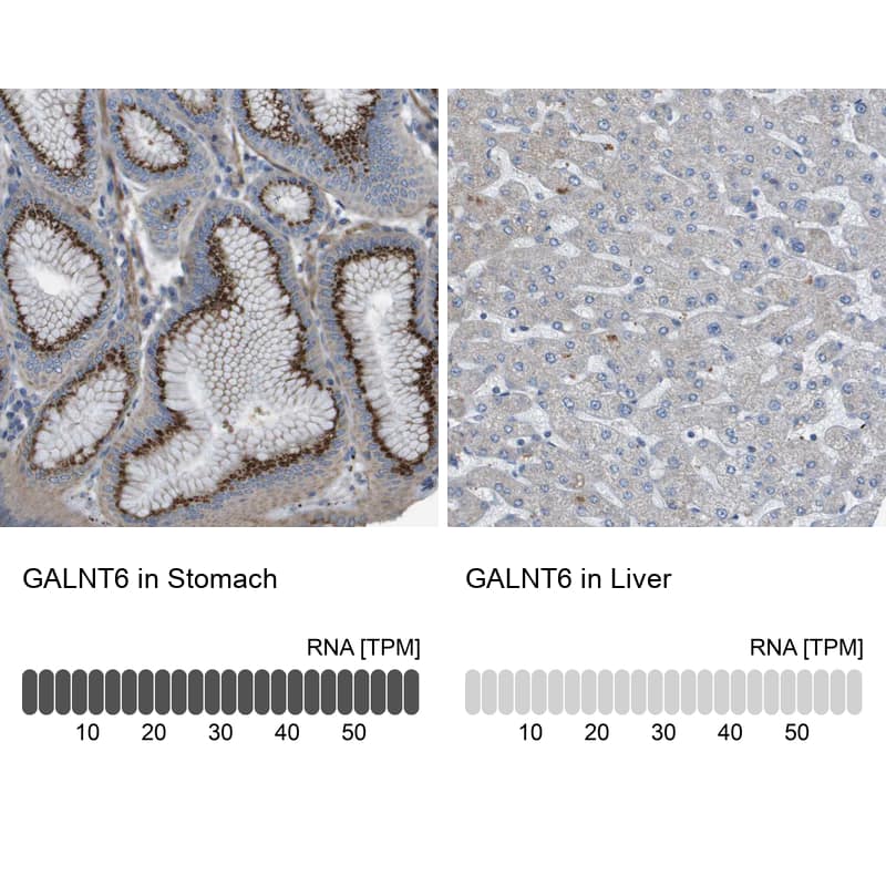 GALNT6 Antibody - BSA Free Immunohistochemistry-Paraffin: GALNT6 Antibody - BSA Free [NBP1-86059]