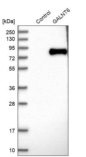 GALNT6 Antibody - BSA Free Western Blot: GALNT6 Antibody - BSA Free [NBP1-86059]