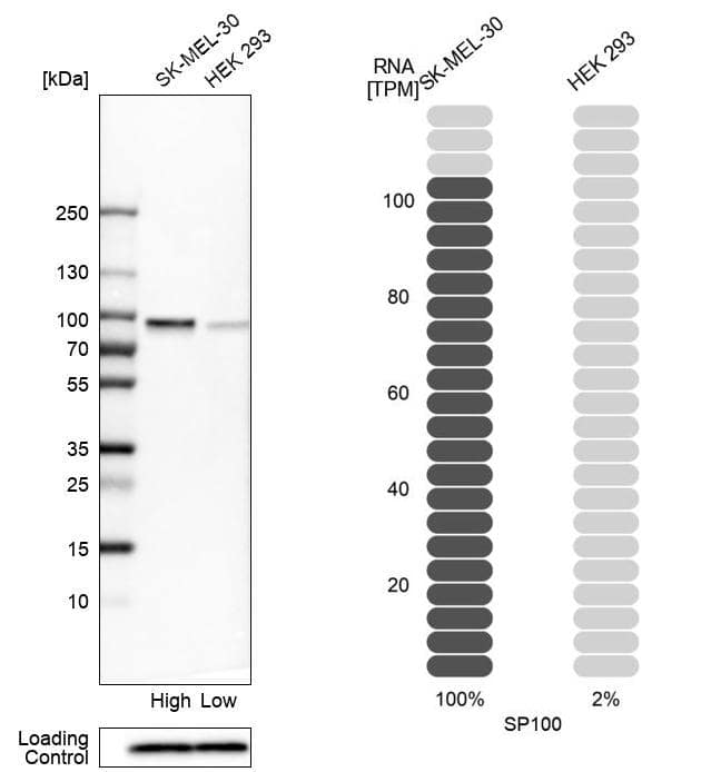 SP100 Antibody - BSA Free Western Blot: SP100 Antibody - BSA Free [NBP1-86060]