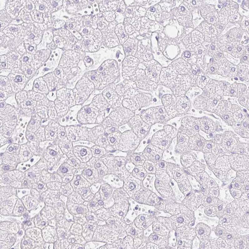 GP2 Antibody - BSA Free Immunohistochemistry-Paraffin: GP2 Antibody - BSA Free [NBP1-86061]