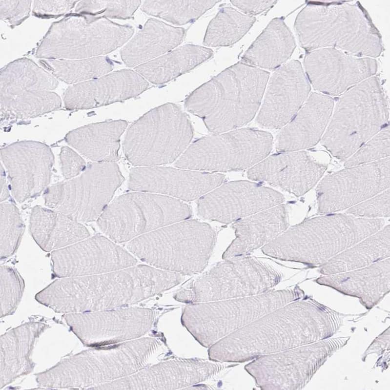 GP2 Antibody - BSA Free Immunohistochemistry-Paraffin: GP2 Antibody - BSA Free [NBP1-86061]