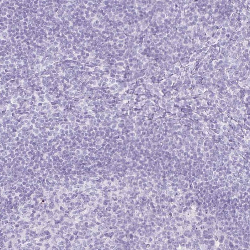 GP2 Antibody - BSA Free Immunohistochemistry-Paraffin: GP2 Antibody - BSA Free [NBP1-86061]