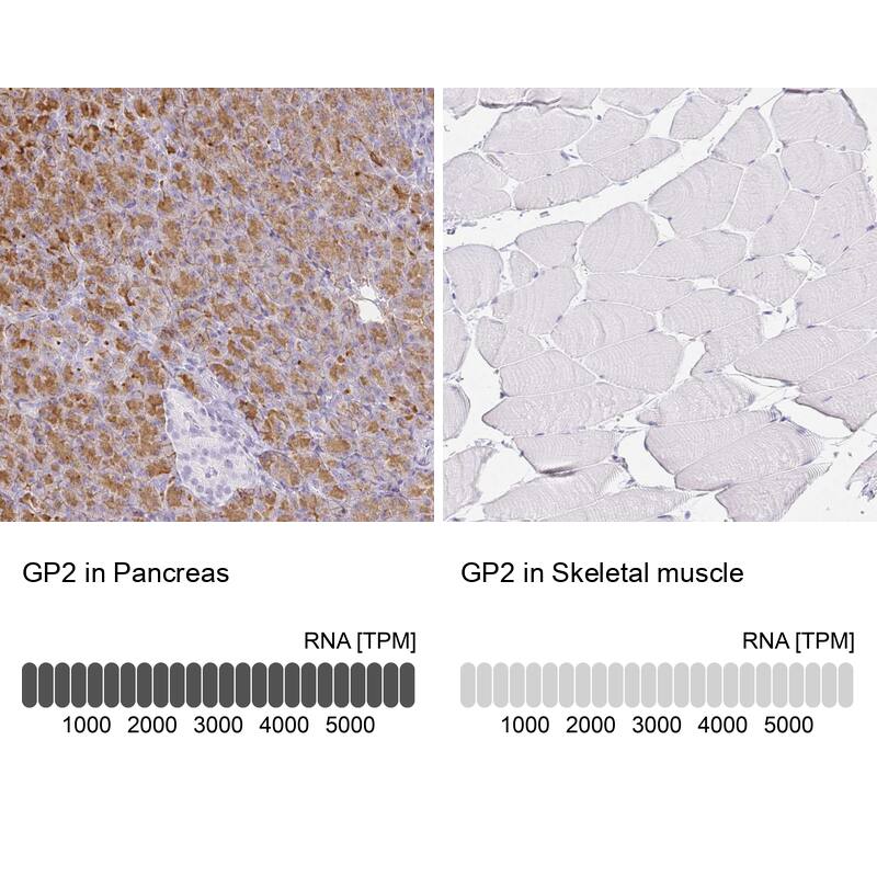 GP2 Antibody - BSA Free Immunohistochemistry-Paraffin: GP2 Antibody - BSA Free [NBP1-86061]