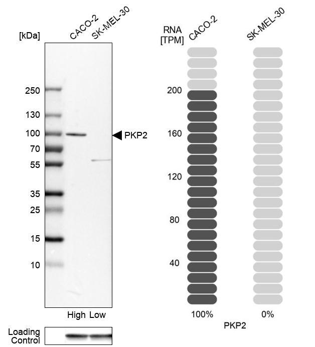 Plakophilin 2 Antibody - BSA Free Western Blot: Plakophilin 2 Antibody - BSA Free [NBP1-86078]