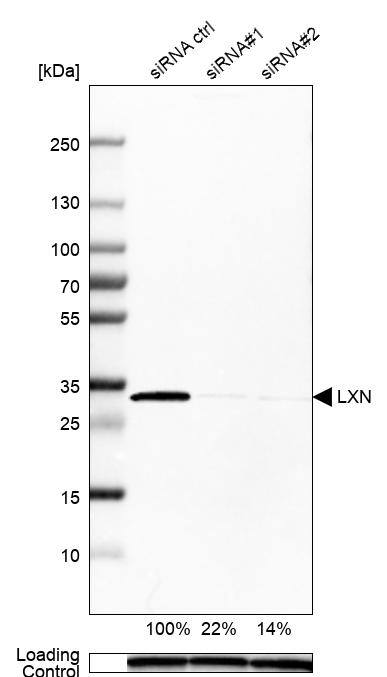 Latexin Antibody - BSA Free Western Blot: Latexin Antibody - BSA Free [NBP1-86079]