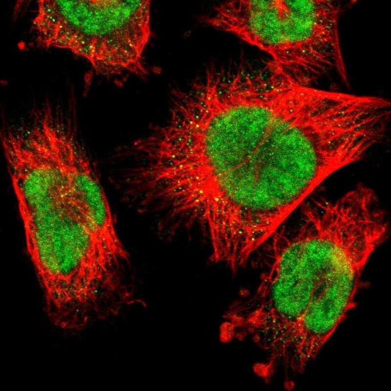 RBM7 Antibody - BSA Free Immunocytochemistry/ Immunofluorescence: RBM7 Antibody [NBP1-86080]