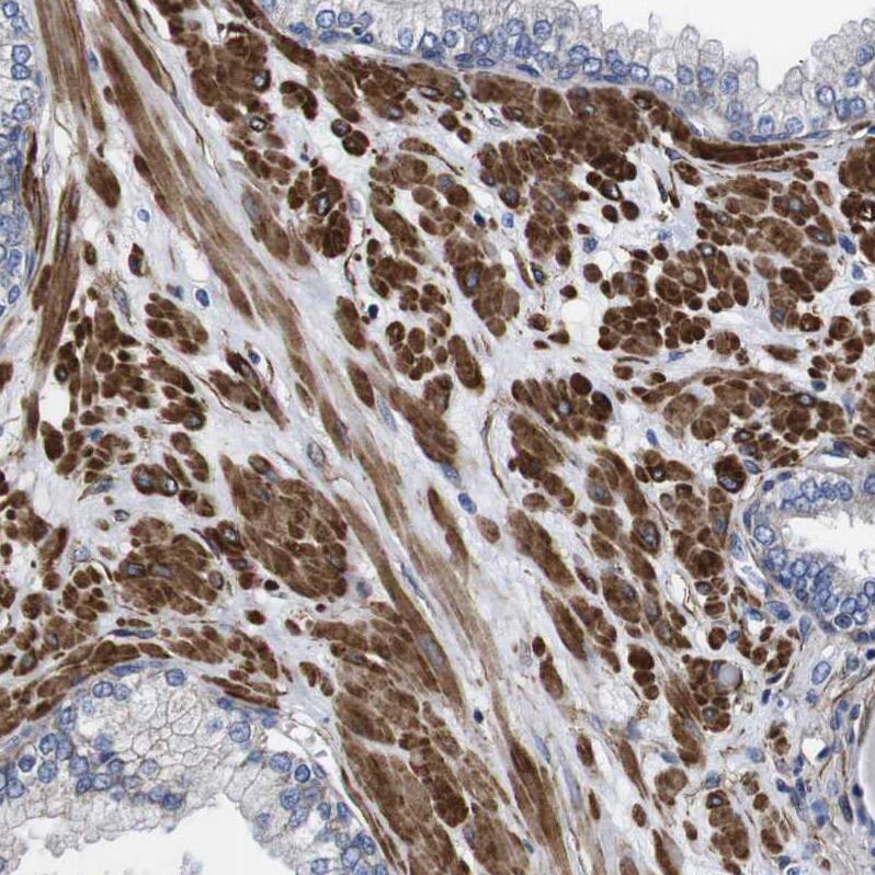 Wnt-10a Antibody - BSA Free Immunohistochemistry-Paraffin: Wnt-10a Antibody - BSA Free [NBP1-86081]