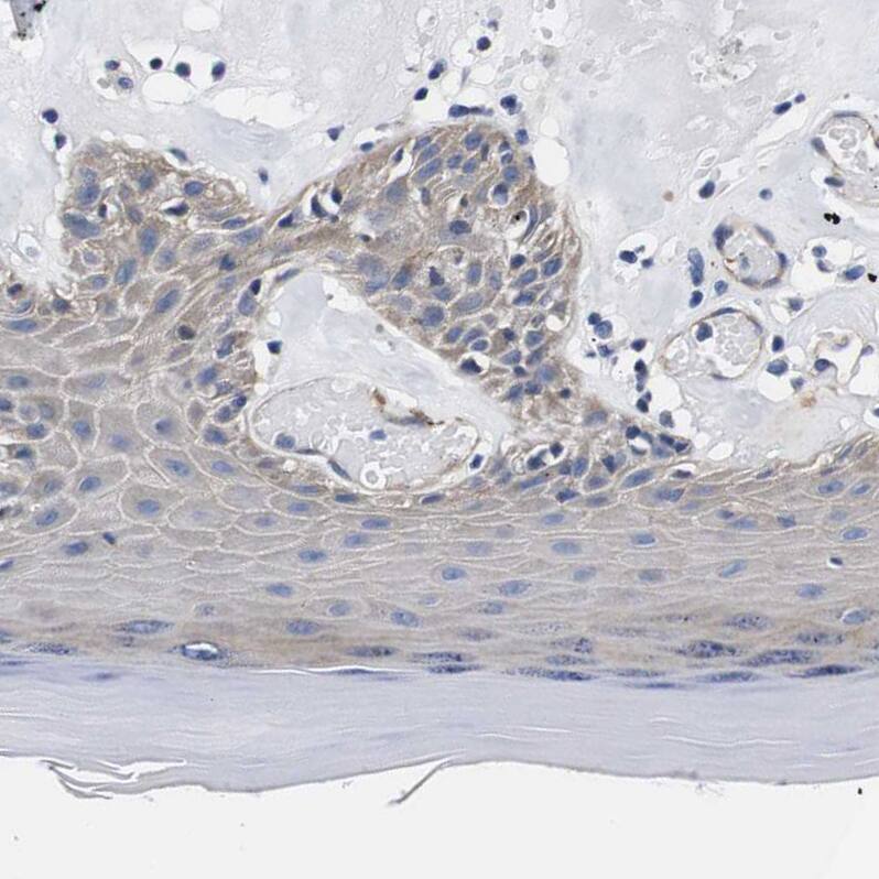 Wnt-10a Antibody - BSA Free Immunohistochemistry-Paraffin: Wnt-10a Antibody - BSA Free [NBP1-86081]