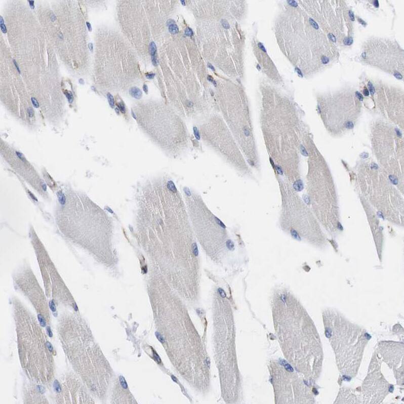 Wnt-10a Antibody - BSA Free Immunohistochemistry-Paraffin: Wnt-10a Antibody - BSA Free [NBP1-86081]