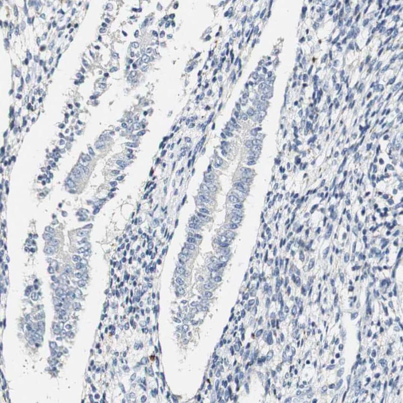 FMO3 Antibody - BSA Free Immunohistochemistry-Paraffin: FMO3 Antibody - BSA Free [NBP1-86083]