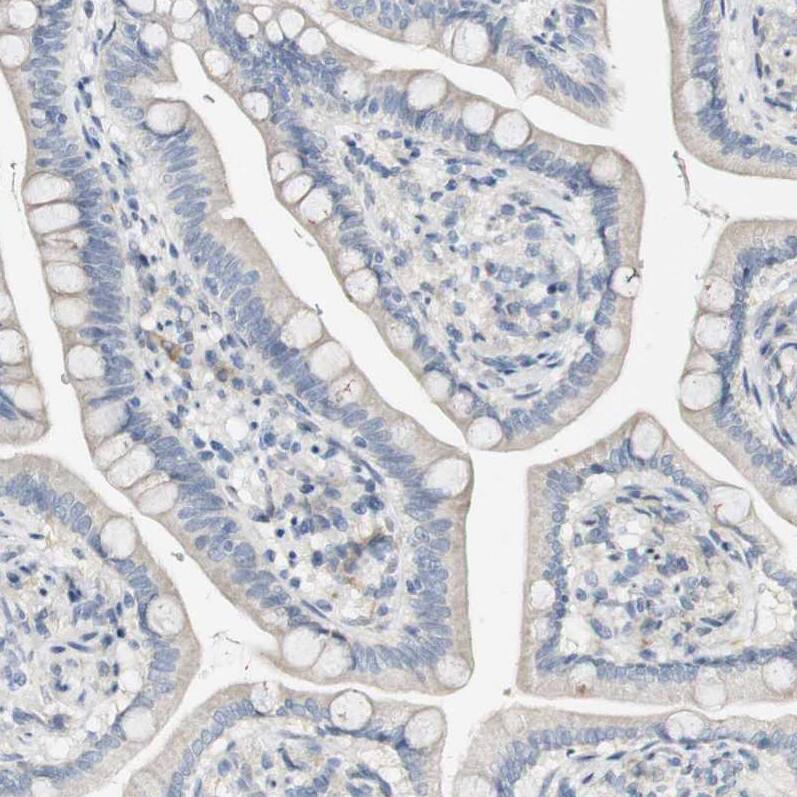 FMO3 Antibody - BSA Free Immunohistochemistry-Paraffin: FMO3 Antibody - BSA Free [NBP1-86083]