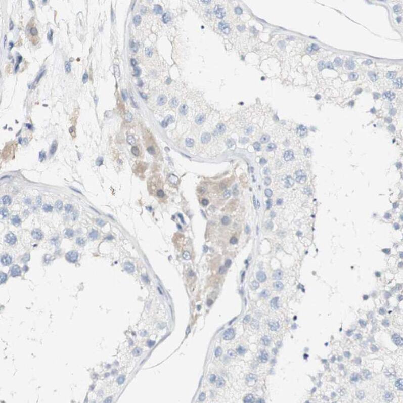 FMO3 Antibody - BSA Free Immunohistochemistry-Paraffin: FMO3 Antibody - BSA Free [NBP1-86083]