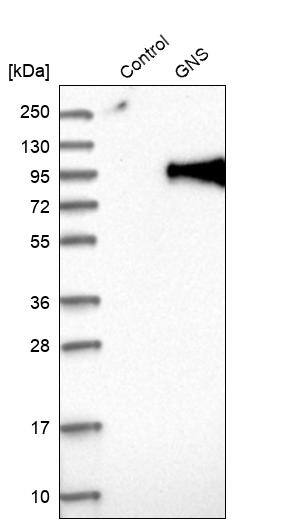 Glucosamine (N-acetyl)-6-Sulfatase/GNS Antibody - BSA Free Western Blot: Glucosamine (N-acetyl)-6-Sulfatase/GNS Antibody - BSA Free [NBP1-86084]