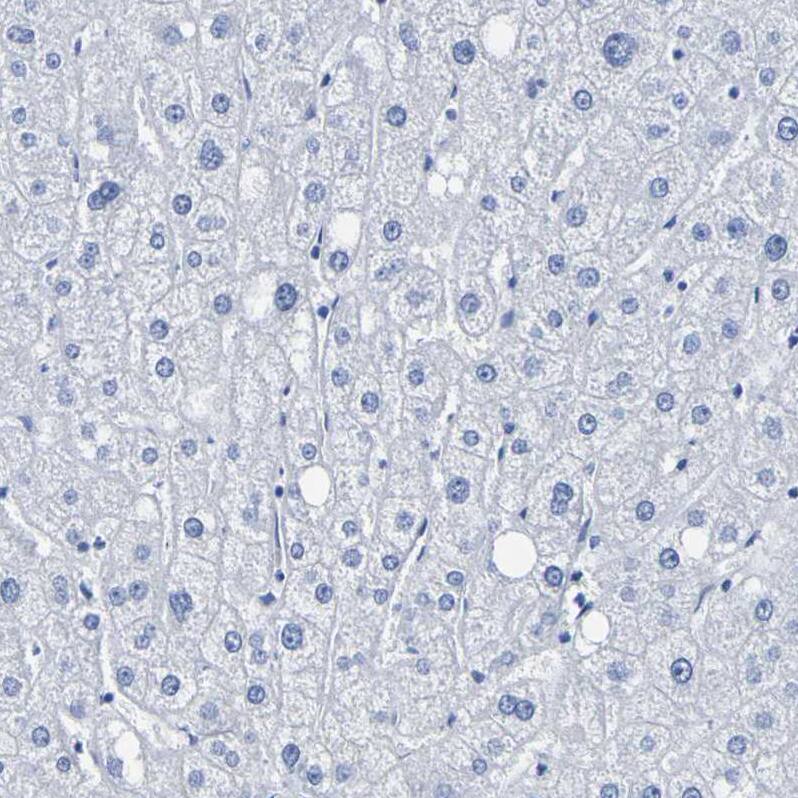 DPEP1 Antibody - BSA Free Immunohistochemistry-Paraffin: DPEP1 Antibody - BSA Free [NBP1-86087]