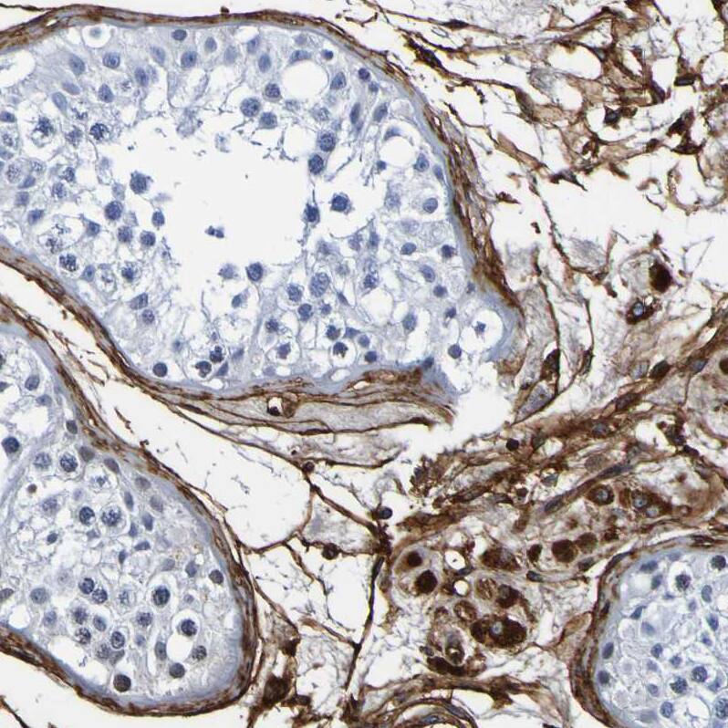 DPEP1 Antibody - BSA Free Immunohistochemistry-Paraffin: DPEP1 Antibody - BSA Free [NBP1-86087]