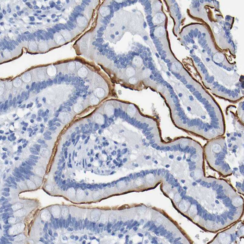 DPEP1 Antibody - BSA Free Immunohistochemistry-Paraffin: DPEP1 Antibody - BSA Free [NBP1-86087]
