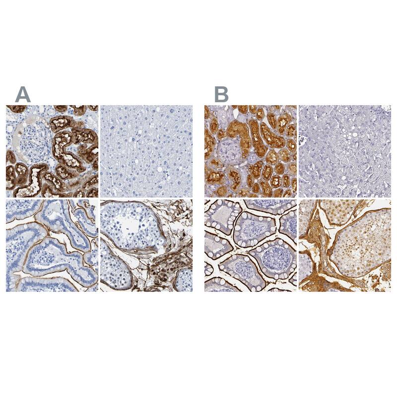 DPEP1 Antibody - BSA Free Immunohistochemistry-Paraffin: DPEP1 Antibody - BSA Free [NBP1-86087]