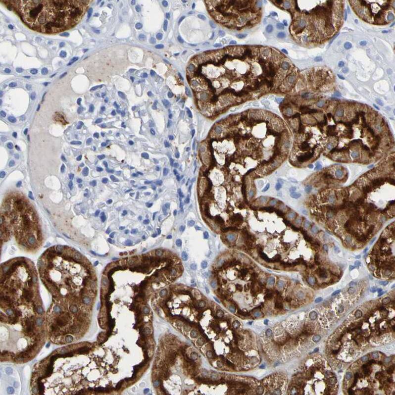 DPEP1 Antibody - BSA Free Immunohistochemistry-Paraffin: DPEP1 Antibody - BSA Free [NBP1-86087]