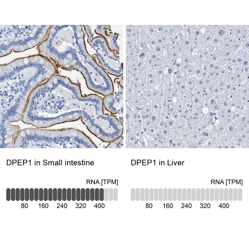 DPEP1 Antibody - BSA Free Immunohistochemistry-Paraffin: DPEP1 Antibody - BSA Free [NBP1-86087]