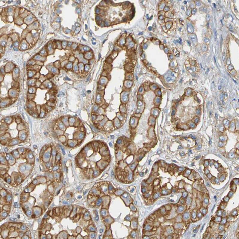 Spectrin beta 2 Antibody - BSA Free Immunohistochemistry-Paraffin: Spectrin beta 2 Antibody - BSA Free [NBP1-86088]
